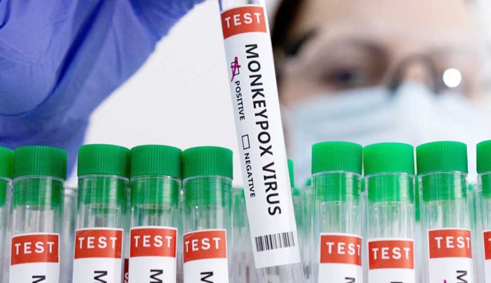 Spain working with vaccine to thwart Gay community spread monkey pox Agency photo